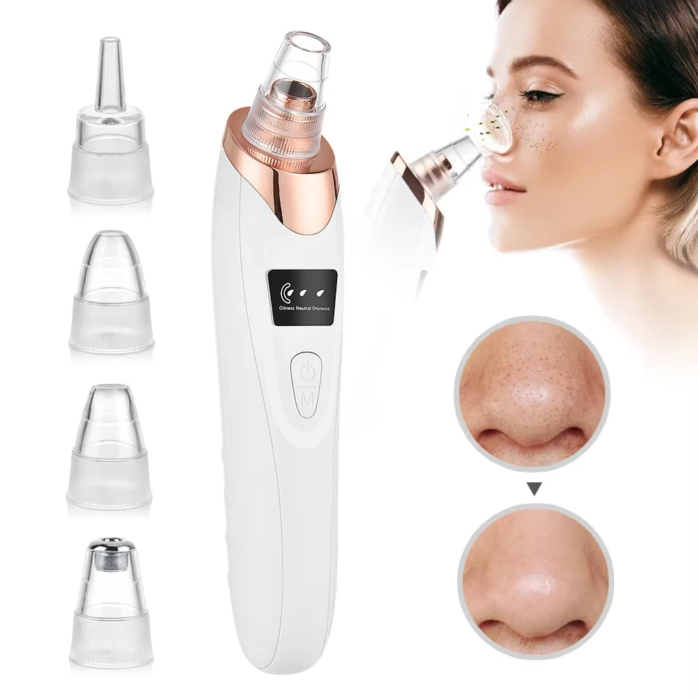 Revolutionary Blackhead Remover Vacuum: Your Ultimate Electric Pore Cleaner for Flawless Skin!