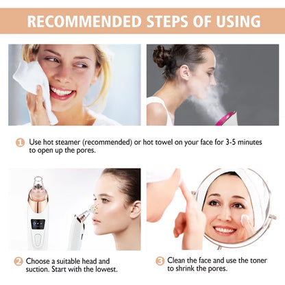 Revolutionary Blackhead Remover Vacuum: Your Ultimate Electric Pore Cleaner for Flawless Skin!